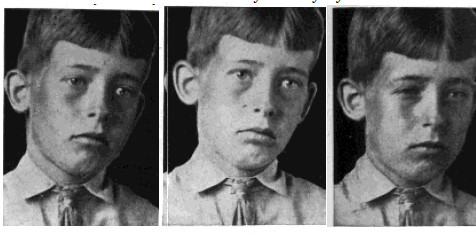 Soggetto fotografato da Bates mentre si sforzava di vedere
